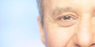 Las famosas “patas de gallo”