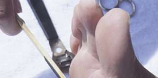 ¡Evita callosidades en la piel!