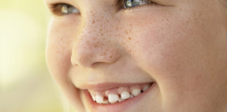 Cuidado… Pecas que pueden mutar en cáncer de piel