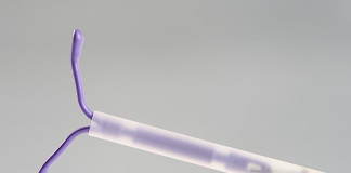 Todo lo que necesitas saber sobre el DIU Todo lo que necesitas saber sobre el DIU