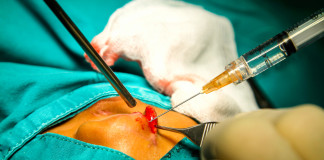 Cómo corregir el labio y paladar hendido Cómo corregir el labio y paladar hendido