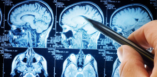 La contaminación envejece al cerebro La contaminación envejece al cerebro