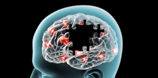 Hábitos que ayudan a reducir el riesgo de Alzheimer