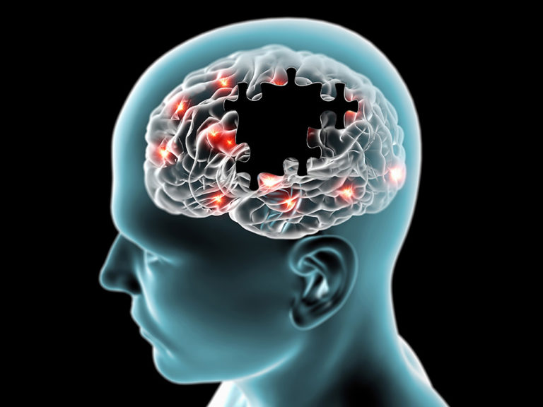 Hábitos que ayudan a reducir el riesgo de Alzheimer