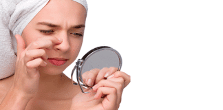 Cómo quitar los puntos negros