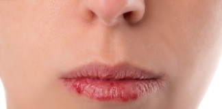 Cómo curar los labios secos