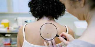 Qué es el cáncer de piel y cómo detectarlo