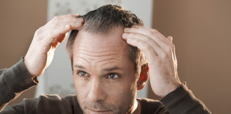 Causas de la pérdida del cabello