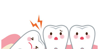 Conoce más de las muelas del juicio