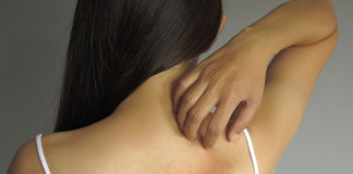 Las alergias más raras