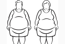 Conoce más acerca de la obesidad mórbida