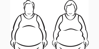 Conoce más acerca de la obesidad mórbida