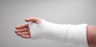 Cuidados para el yeso