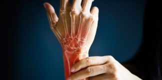 ¿Qué es la artritis?