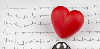 Fibrilación auricular, la epidemia del siglo