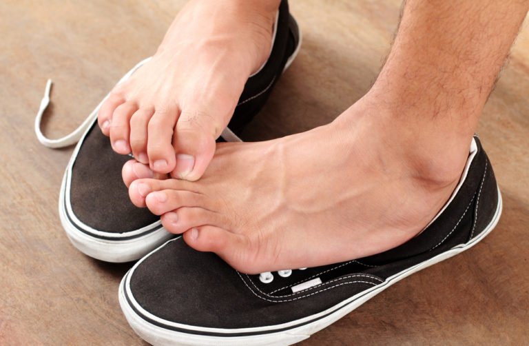 ¿Cómo prevenir el pie de atleta?