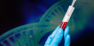 Qué es la hemofilia Qué es la hemofilia