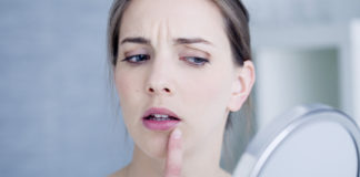 Herpes labial, cómo curarlo y evitar su contagio
