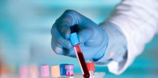 Con un análisis de sangre podrías saber 10 años antes si tendrás cáncer