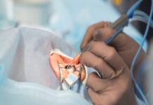 Las ventajas y desventajas de la cirugía láser ocular