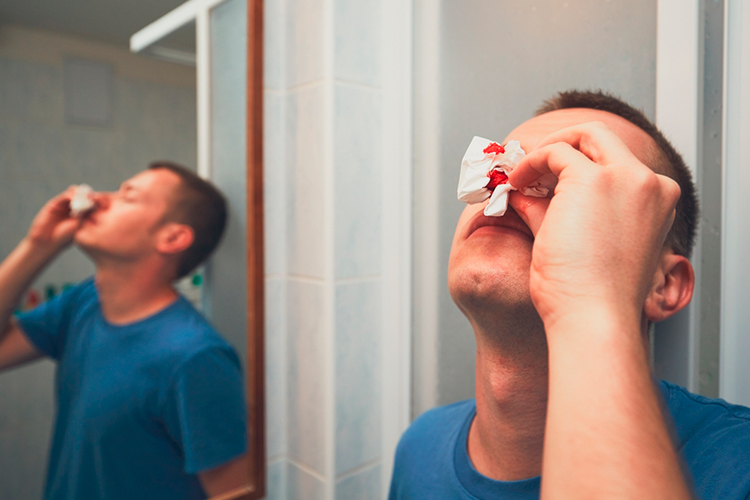 Razones más comunes del sangrado de nariz